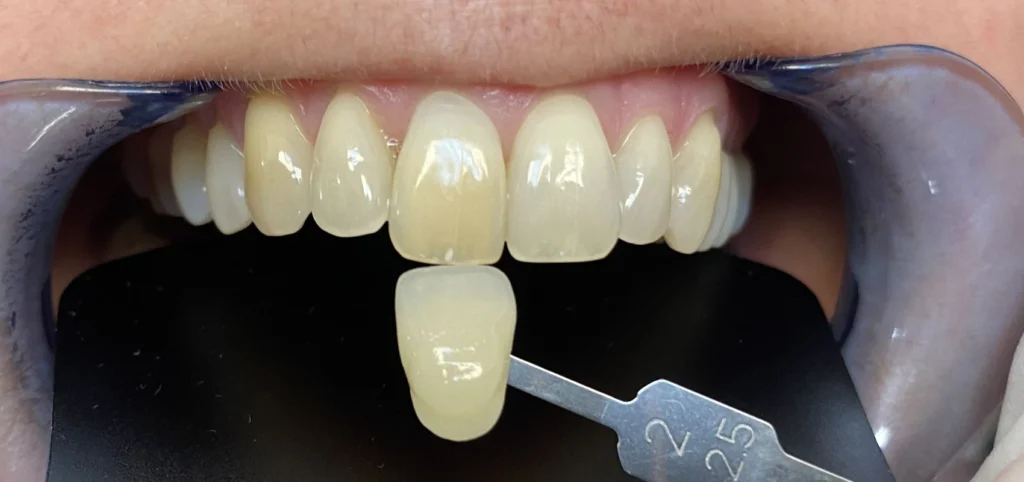 eclaircissement unitaire trouillas dr cesaro