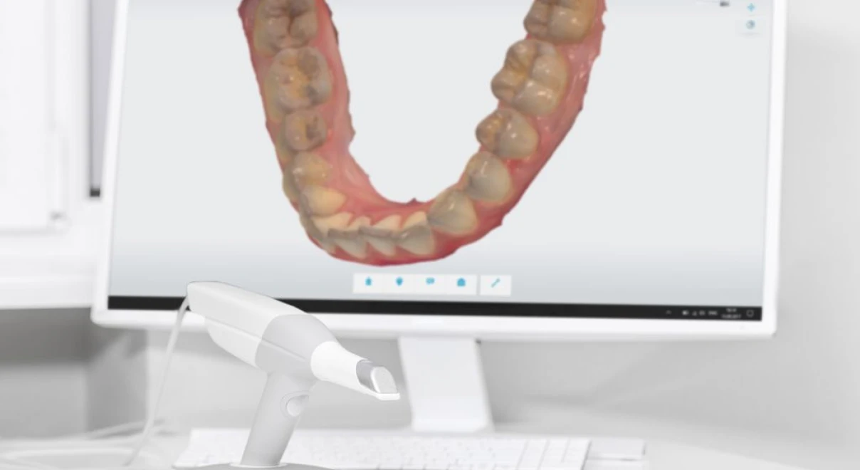 scanner dentaire orthodontie trouillas