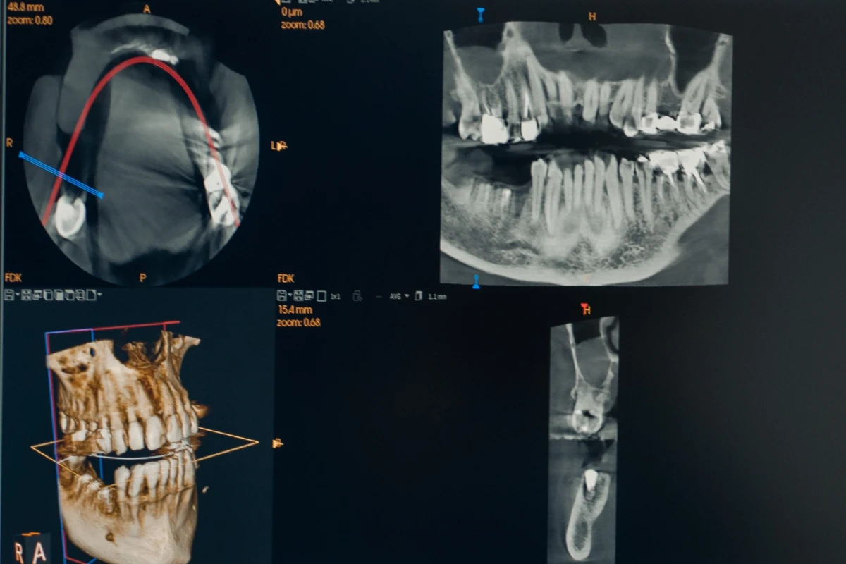 technologie imagerie dentiste trouillas