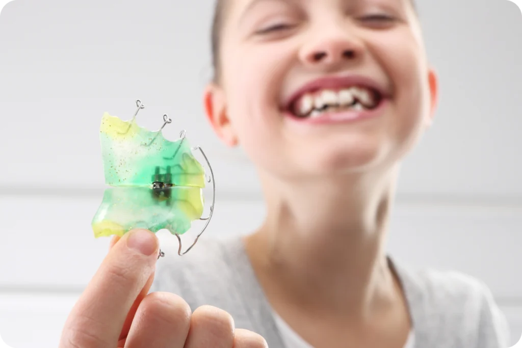 plaque palatine polestress