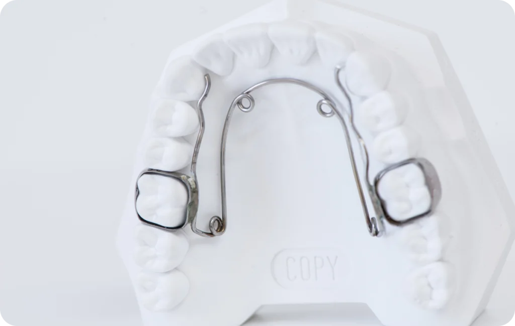 quad helix prades Dr Sophie CESARO - Dentiste à Trouillas quad helix prades