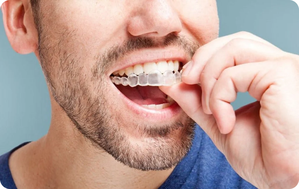 consultation orthodontiste thuir